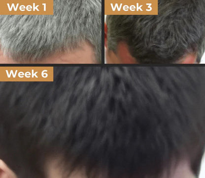 Real customer hairline photos at Week 1, Week 3 and Week 6